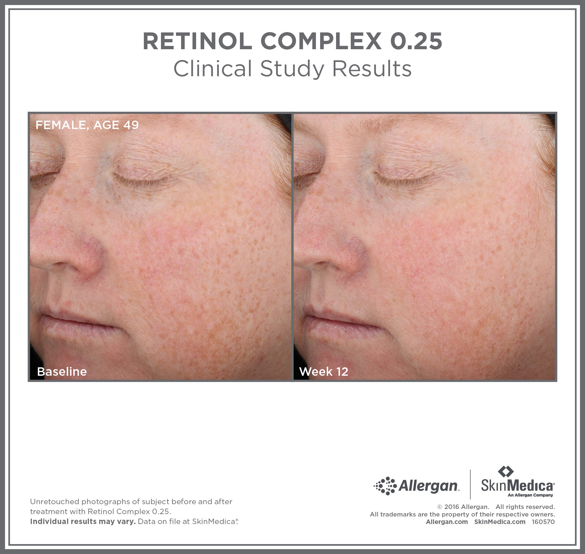 <transcy>SkinMedica Retinol Complex 0.25 (1 oz)</transcy>