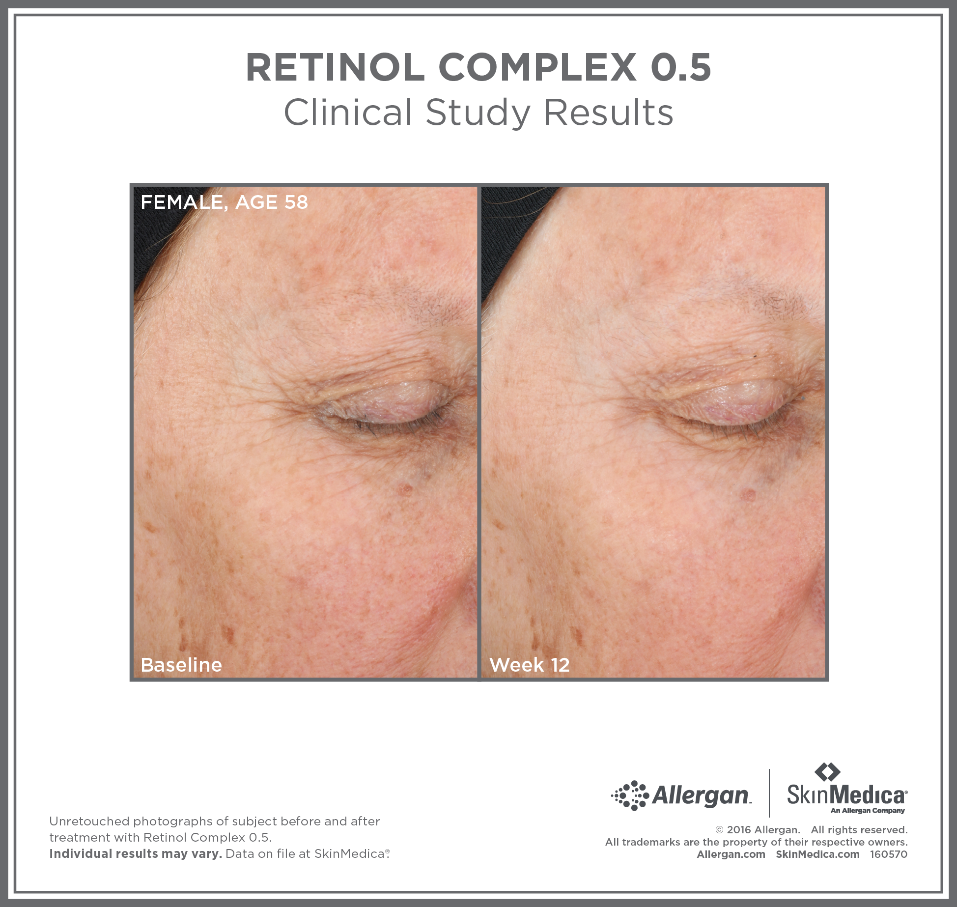<transcy>SkinMedica Retinol Complex 0,5 (1 oz)</transcy>