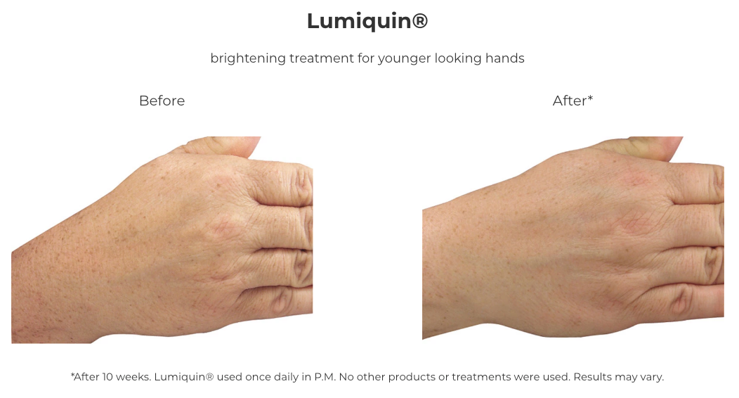 Revision Skincare Lumiquin® (1.7 oz)