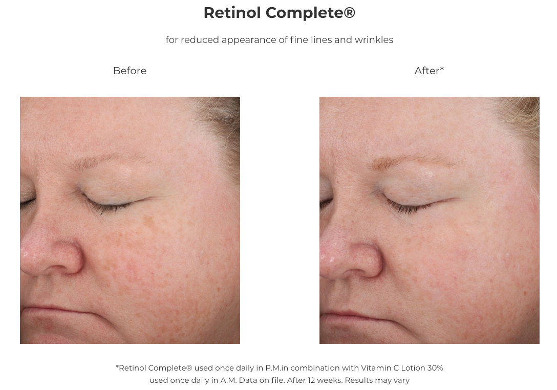 Revision Skincare Retinol Complete® 0.5 (1 oz)