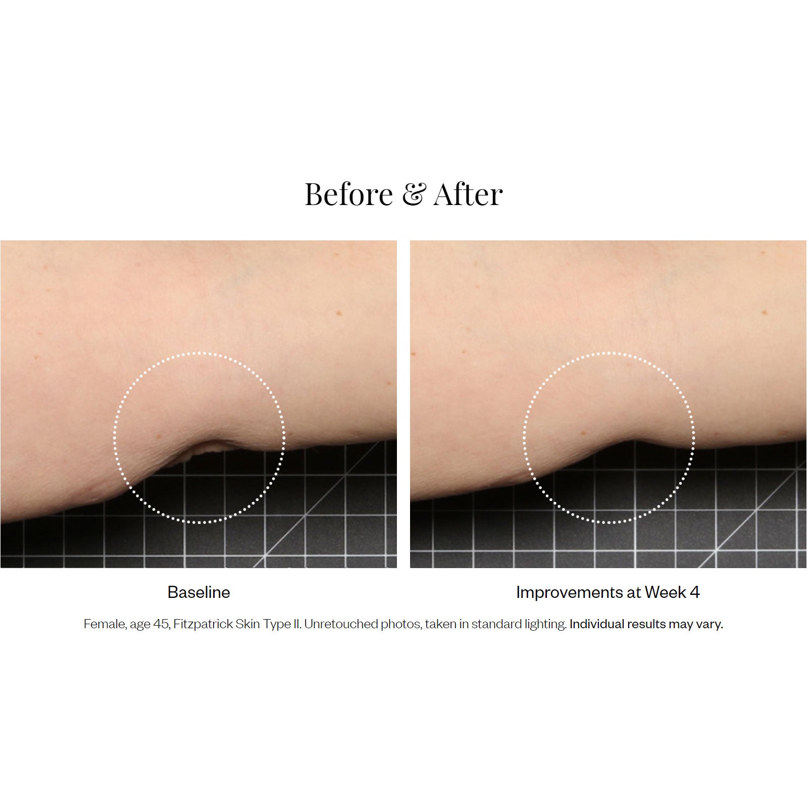 SkinMedica Firm & Tone Body Lotion Results