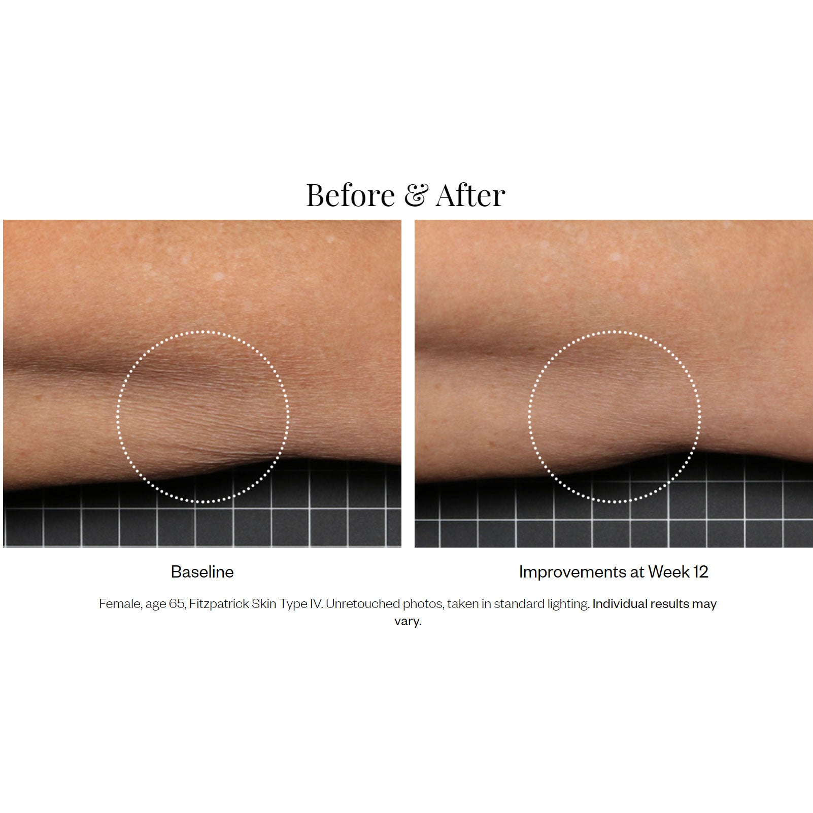 SkinMedica Firm & Tone Body Lotion Before and After Results