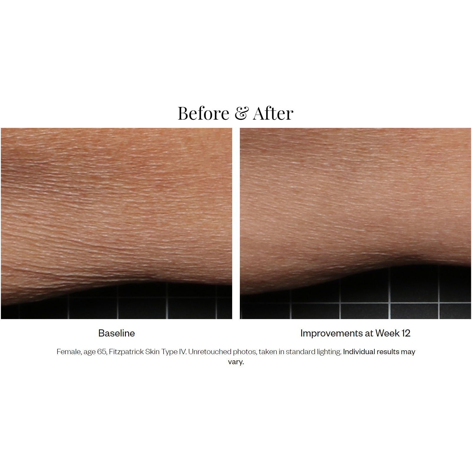 SkinMedica Firm & Tone Body Lotion Results
